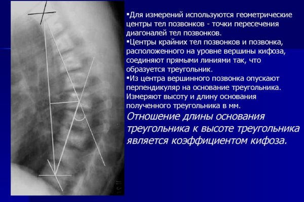 Ссылка на кракен тор kraken2 4aa337
